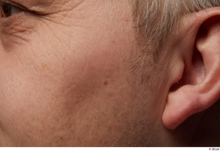 HD Face Skin Agustin Wilkerson cheek ear face skin pores…